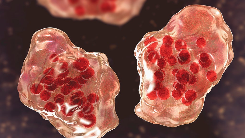 Central Minnesota county reports "several cases of suspected measles" — WCCO / CBS Minnesota, Chanhassen Health news