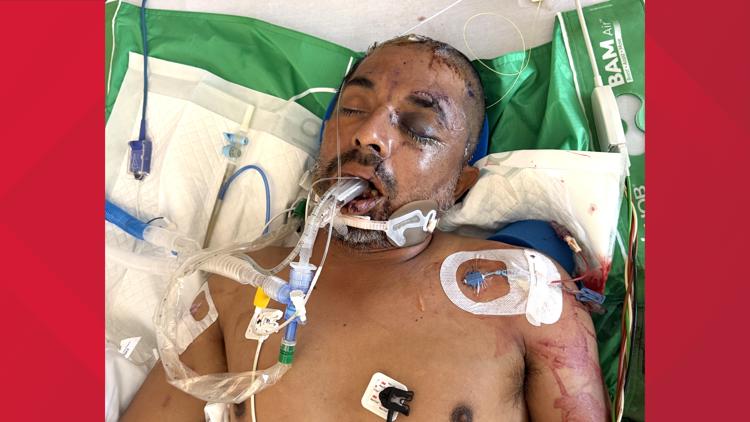 University Hospital asks for help identifying unconscious patient hit by truck Saturday evening — KENS 5 (San Antonio), Chanhassen Health news