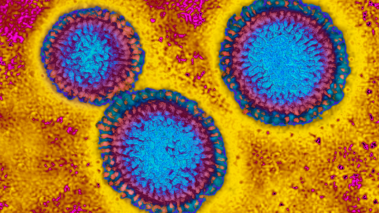 Flu hospitalizations 'slightly higher' than usual, officials urge vaccinations — FOX 9, Chanhassen Health news